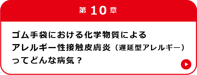 第10章 ゴム手袋における化学物質によるアレルギー性接触皮膚炎（遅延型アレルギー）